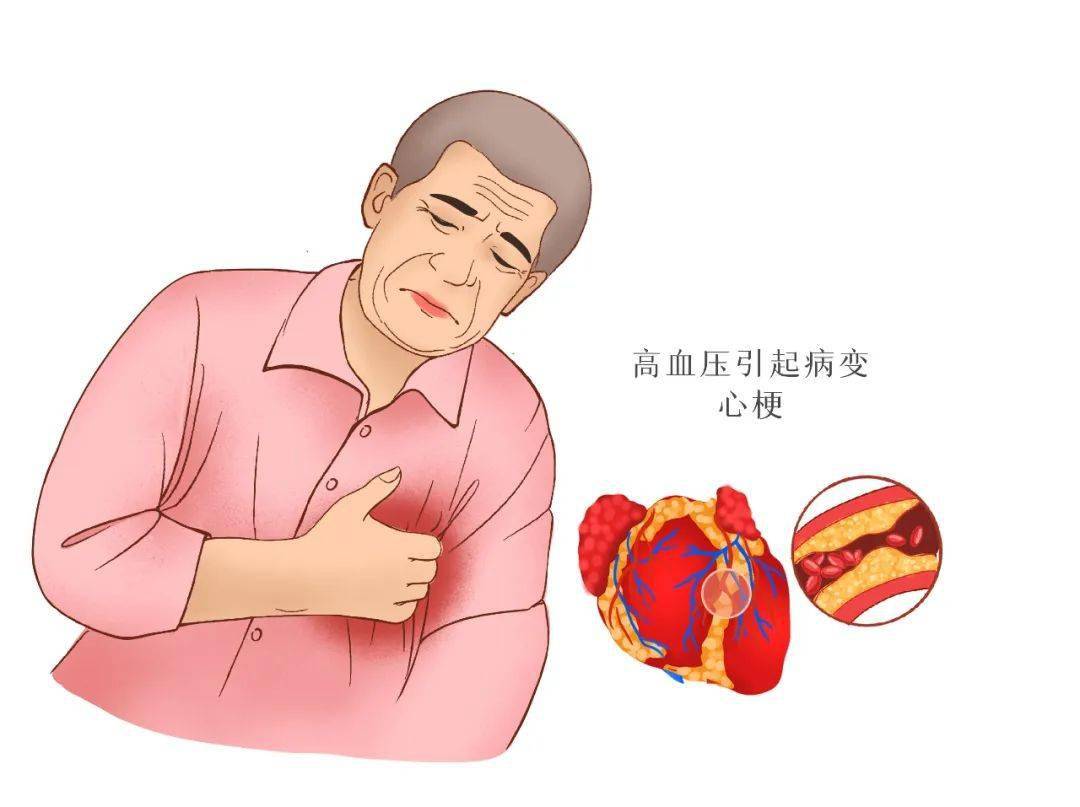 冠心病毒最新研究進(jìn)展與防控策略，冠心病毒最新研究進(jìn)展與防控策略探討