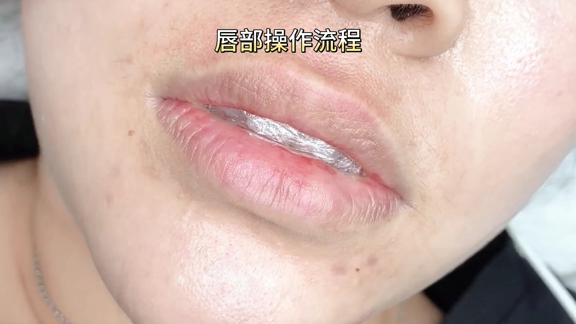 唇部最新技術(shù)，重塑美麗與自信的源泉，唇部最新技術(shù)，重塑美麗，自信之源