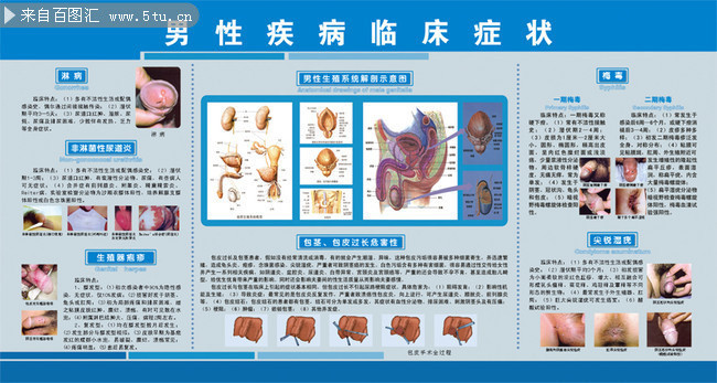 男科疾病圖片大全，了解、預(yù)防與治療，男科疾病圖片詳解，認(rèn)識(shí)、預(yù)防與治療