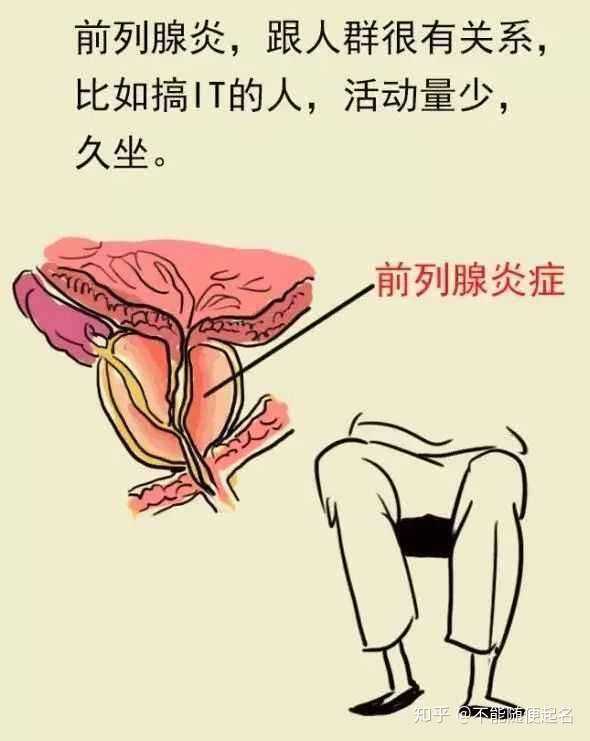 慢性前列腺炎能否治愈，深度解析與希望之光，慢性前列腺炎能否治愈，深度剖析與希望展望