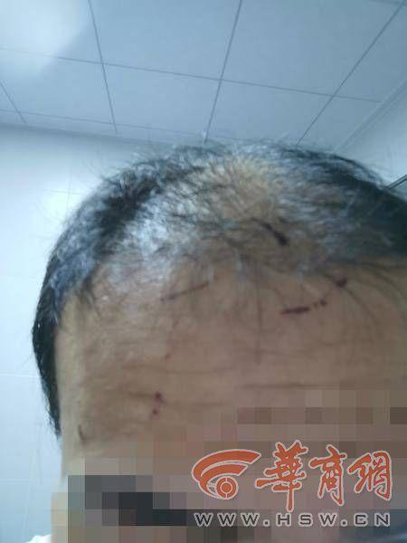 西安又有兩名男子家暴妻子新事件，深度分析與反思，西安再曝兩起男子家暴妻子事件，深度分析與反思