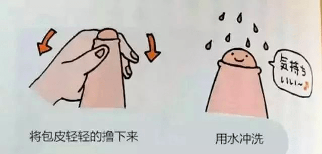 后悔9歲做包莖手術(shù)，一個(gè)關(guān)于成長與選擇的反思，成長與選擇的反思，后悔9歲做包莖手術(shù)的心路歷程
