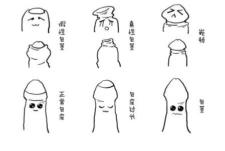 包皮手術(shù)后恢復(fù)正常的時長，全面解析與關(guān)注要點(diǎn)，包皮手術(shù)后恢復(fù)正常的時長詳解，全面解析及關(guān)注要點(diǎn)