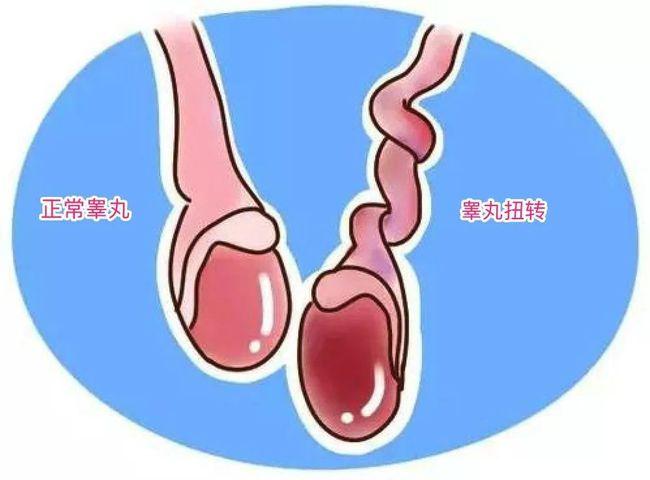 原因
