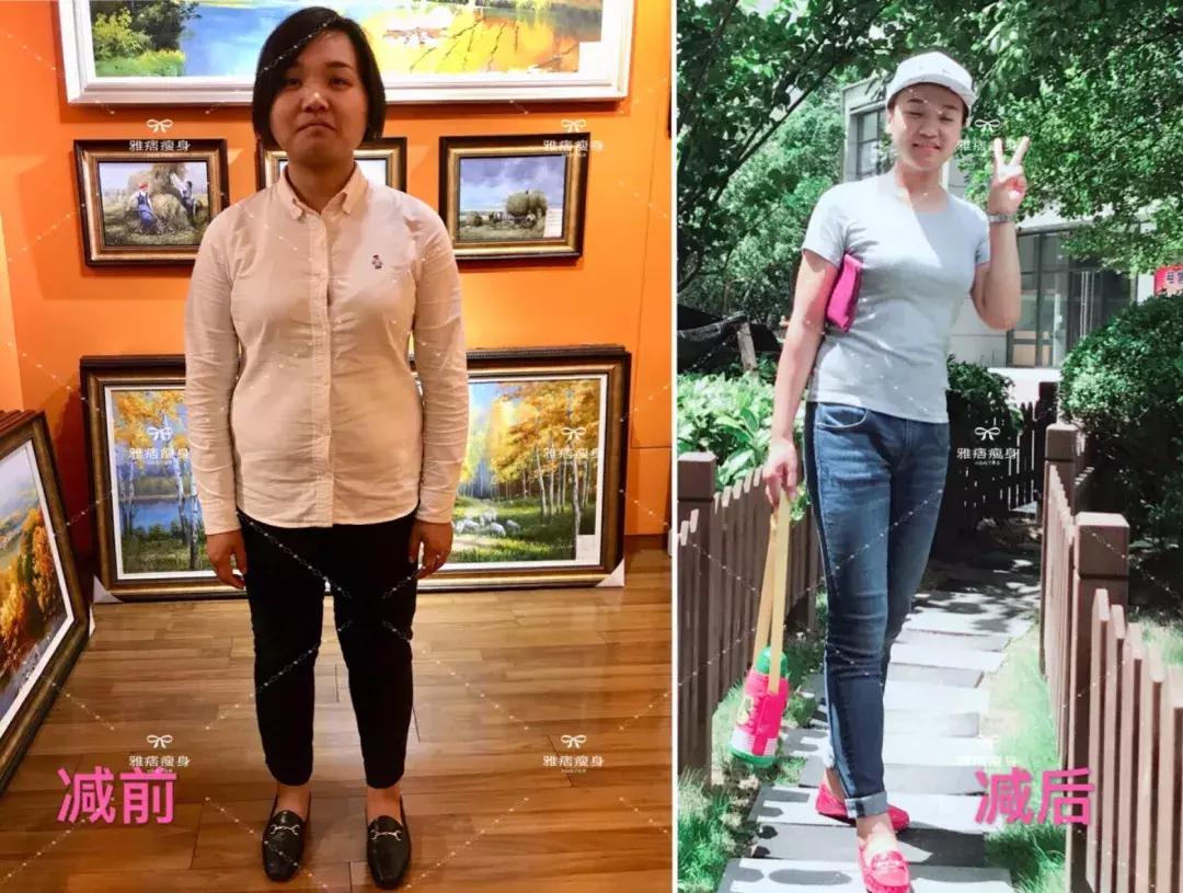 女孩子減肥做什么運動更有效？全面解析適合女性的運動方式，女性減肥運動攻略，高效運動方式全面解析，助力女性塑造完美身材