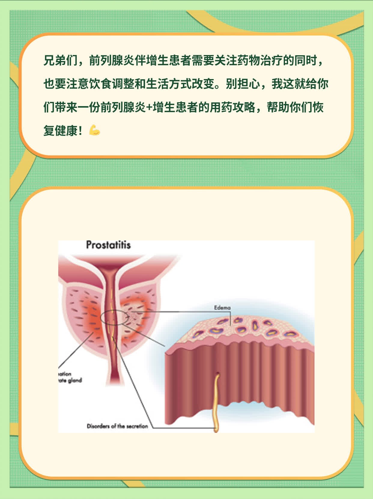 前列腺增生藥物治療指南，了解藥物治療與選擇，前列腺增生藥物治療詳解，指南與選擇