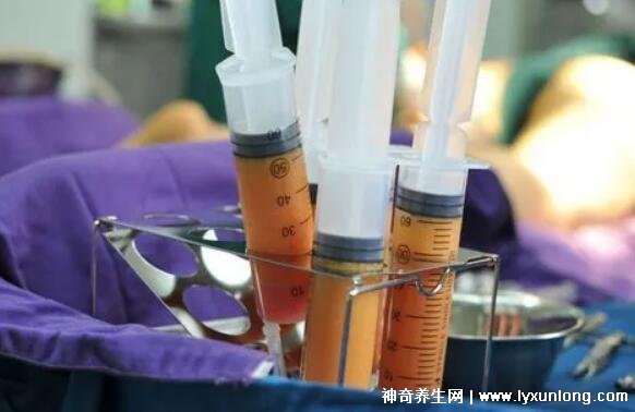 抽脂肪對身體有什么副作用，抽脂肪可能的副作用與風(fēng)險(xiǎn)，身體反應(yīng)及注意事項(xiàng)